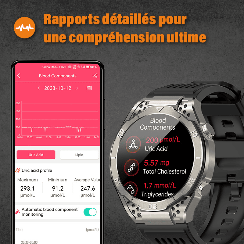 Apollo - Montre connectée ECG
